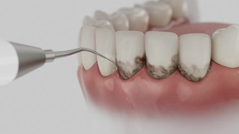 Reliable Tooth Extraction contractor in McCurtain County County, OK by Dentist Open Now